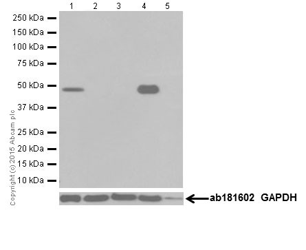Western blot - Anti-PAX8 antibody [EPR18715] (AB191870), expandable thumbnail