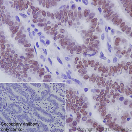 Immunohistochemistry (Formalin/PFA-fixed paraffin-embedded sections) - Anti-PAX8 antibody [EPR18715] - BSA and Azide free (AB246332), expandable thumbnail