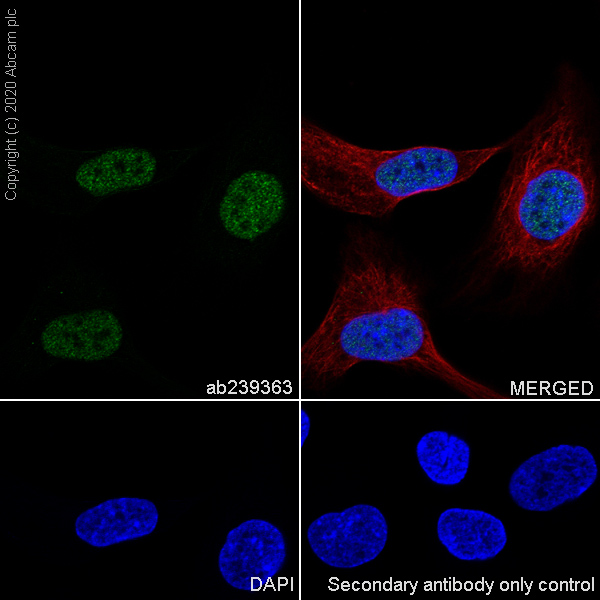 Immunocytochemistry/ Immunofluorescence - Anti-PAX8 antibody [EPR23508-20] (ab239363), expandable thumbnail