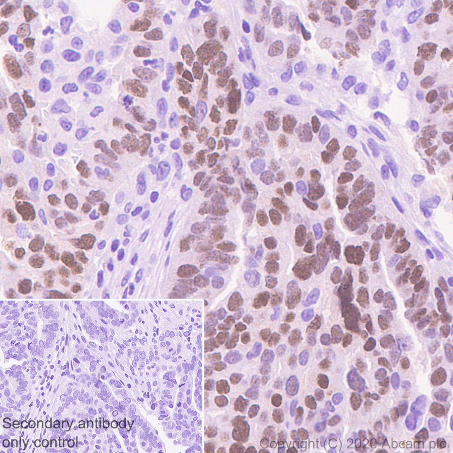 Immunohistochemistry (Formalin/PFA-fixed paraffin-embedded sections) - Anti-PAX8 antibody [EPR23508-20] (ab239363), expandable thumbnail