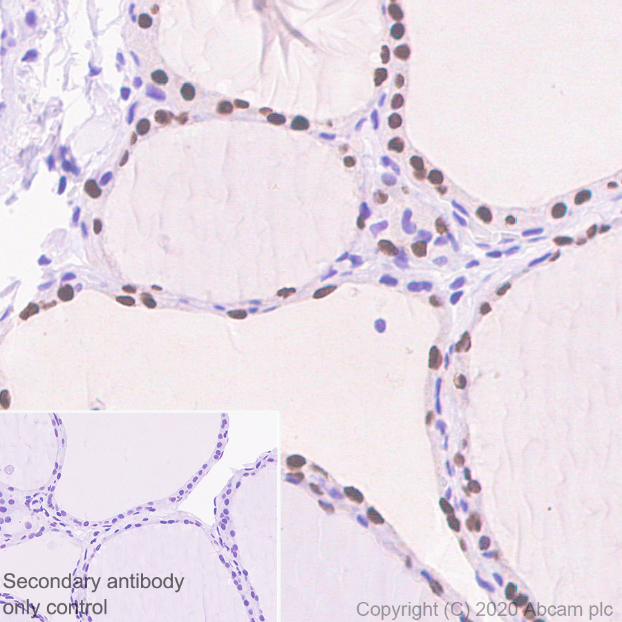 Immunohistochemistry (Formalin/PFA-fixed paraffin-embedded sections) - Anti-PAX8 antibody [EPR23508-20] (ab239363), expandable thumbnail