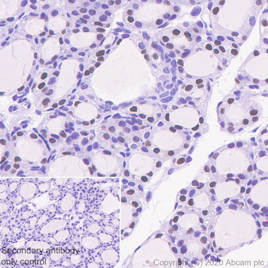 Immunohistochemistry (Formalin/PFA-fixed paraffin-embedded sections) - Anti-PAX8 antibody [EPR23508-20] (ab239363), expandable thumbnail