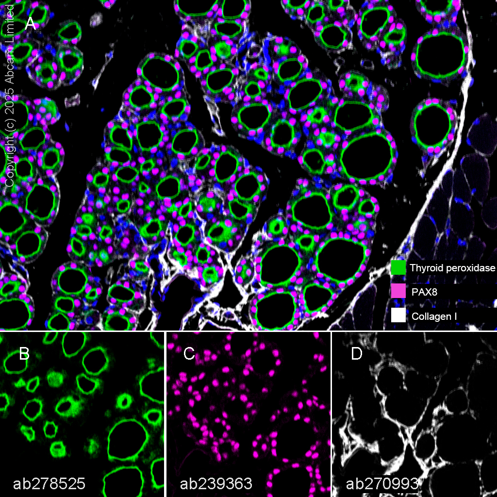 Multiplex immunohistochemistry - Anti-PAX8 antibody [EPR23508-20] (ab239363), expandable thumbnail