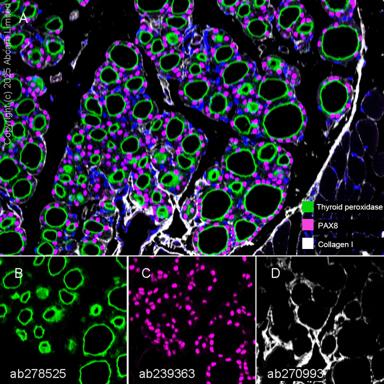 Multiplex immunohistochemistry - Anti-PAX8 antibody [EPR23508-20] (AB239363)