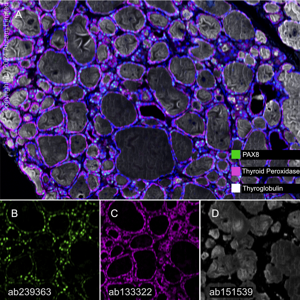 Multiplex immunohistochemistry - Anti-PAX8 antibody [EPR23508-20] (AB239363)