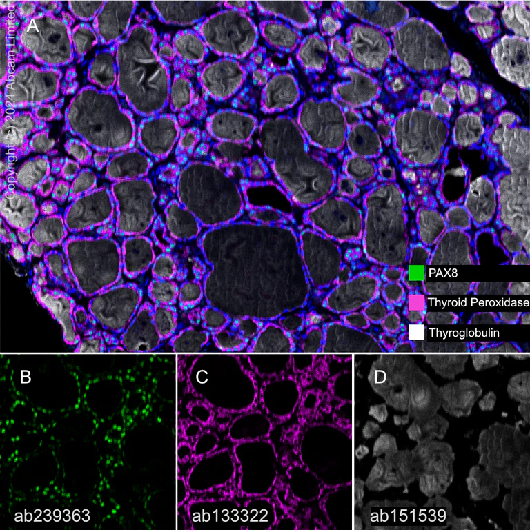 Multiplex immunohistochemistry - Anti-PAX8 antibody [EPR23508-20] (AB239363)