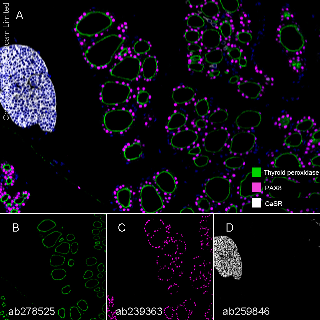 Multiplex immunohistochemistry - Anti-PAX8 antibody [EPR23508-20] - BSA and Azide free (ab275259), expandable thumbnail