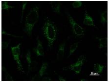 Immunocytochemistry - Anti-PAX8 antibody [PAX8R1] (AB53490)