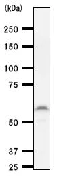 Western blot - Anti-PAX8 antibody [PAX8R1] (AB53490)