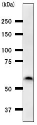 Western blot - Anti-PAX8 antibody [PAX8R1] (AB53490)