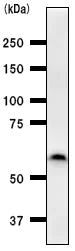 Western blot - Anti-PAX8 antibody [PAX8R1] (AB53490)