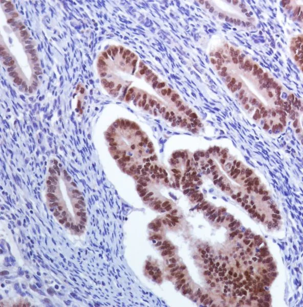 Immunohistochemistry (Formalin/PFA-fixed paraffin-embedded sections) - Anti-PAX8 antibody [SP348] - BSA and Azide free (AB242429)