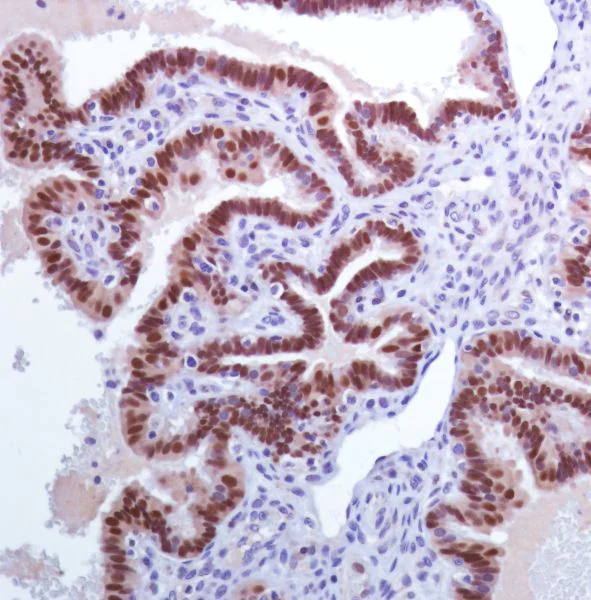 Immunohistochemistry (Formalin/PFA-fixed paraffin-embedded sections) - Anti-PAX8 antibody [SP348] - BSA and Azide free (AB242429)