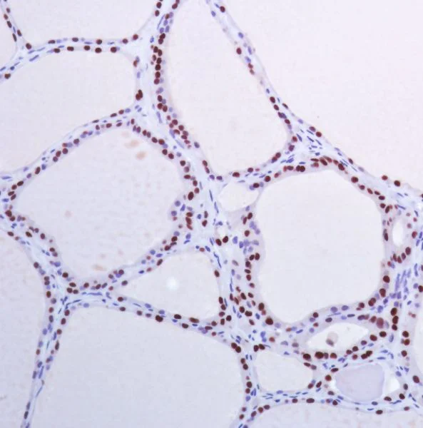 Immunohistochemistry (Formalin/PFA-fixed paraffin-embedded sections) - Anti-PAX8 antibody [SP348] - BSA and Azide free (AB242429)