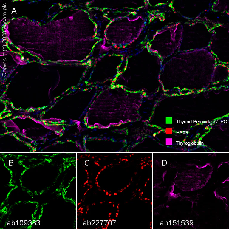 Multiplex immunohistochemistry - Anti-PAX8 antibody [SP348] - BSA and Azide free (AB242429)