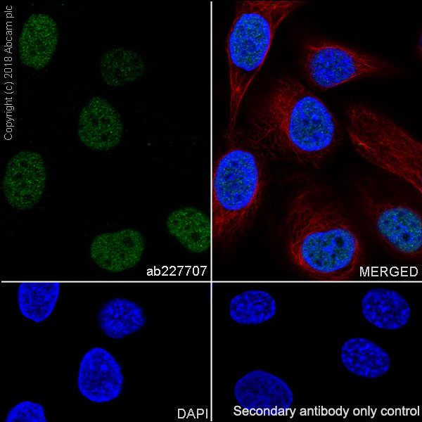 Immunocytochemistry/ Immunofluorescence - Anti-PAX8 antibody [SP348] - N-terminal (AB227707), expandable thumbnail