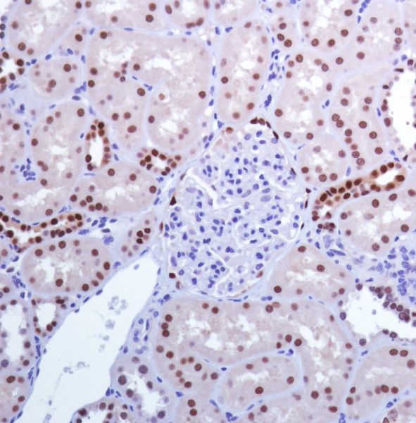 Immunohistochemistry (Formalin/PFA-fixed paraffin-embedded sections) - Anti-PAX8 antibody [SP348] - N-terminal (ab227707), expandable thumbnail