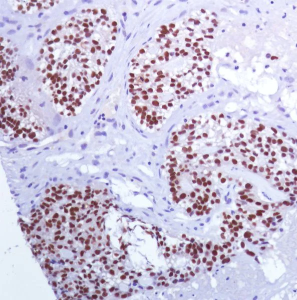 Immunohistochemistry (Formalin/PFA-fixed paraffin-embedded sections) - Anti-PAX8 antibody [SP348] - N-terminal (AB227707)