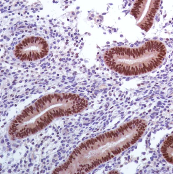 Immunohistochemistry (Formalin/PFA-fixed paraffin-embedded sections) - Anti-PAX8 antibody [SP348] - N-terminal (AB227707)