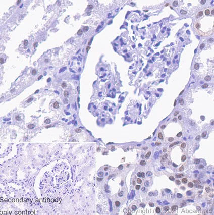 Immunohistochemistry (Formalin/PFA-fixed paraffin-embedded sections) - Anti-PAX8 antibody [SP348] - N-terminal (AB227707)