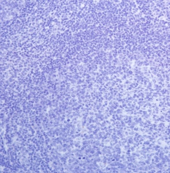 Immunohistochemistry (Formalin/PFA-fixed paraffin-embedded sections) - Anti-PAX8 antibody [SP348] - N-terminal (ab227707), expandable thumbnail