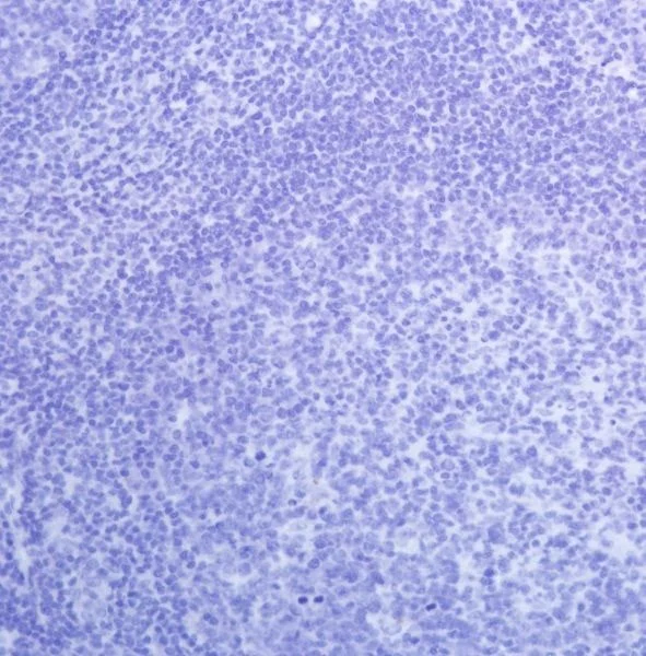Immunohistochemistry (Formalin/PFA-fixed paraffin-embedded sections) - Anti-PAX8 antibody [SP348] - N-terminal (AB227707)