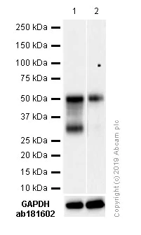 Western blot - Anti-PAX8 antibody [SP348] - N-terminal (AB227707)
