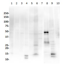 Western blot - Anti-PAX8 antibody [SP348] - N-terminal (ab227707), expandable thumbnail
