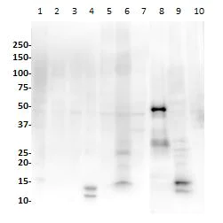 Western blot - Anti-PAX8 antibody [SP348] - N-terminal (AB227707)