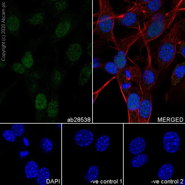 Immunocytochemistry/ Immunofluorescence - Anti-PAX9 antibody [7C2] (AB28538)