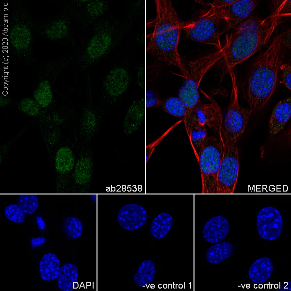 Immunocytochemistry/ Immunofluorescence - Anti-PAX9 antibody [7C2] - BSA and Azide free (AB255977)