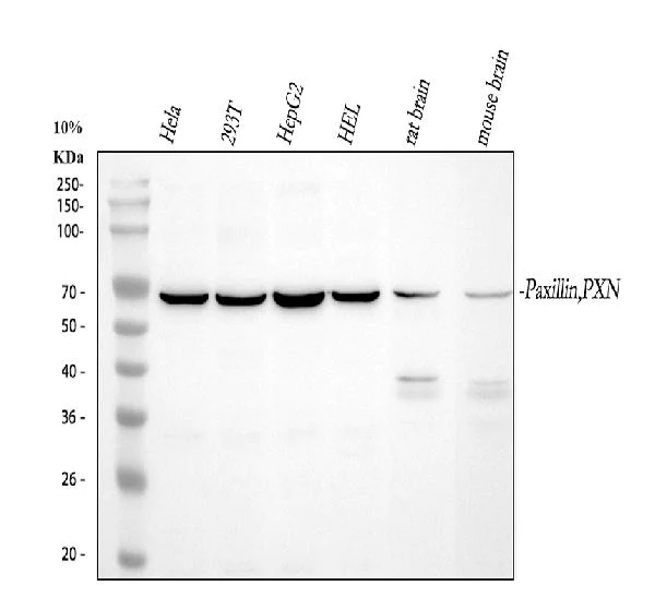Western blot - Anti-Paxillin antibody - C-terminal (AB191007)