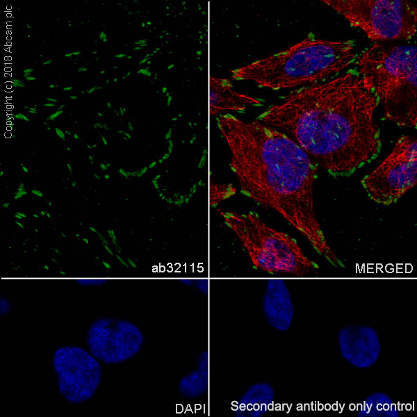 Immunocytochemistry/ Immunofluorescence - Anti-Paxillin antibody [E228] (AB32115), expandable thumbnail