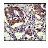 Immunohistochemistry (Formalin/PFA-fixed paraffin-embedded sections) - Anti-Paxillin antibody [E228] (ab32115), expandable thumbnail