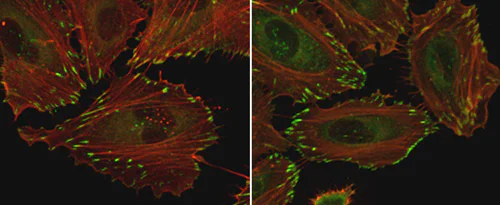 Immunocytochemistry/ Immunofluorescence - Anti-Paxillin antibody [E228] - BSA and Azide free (AB238950)