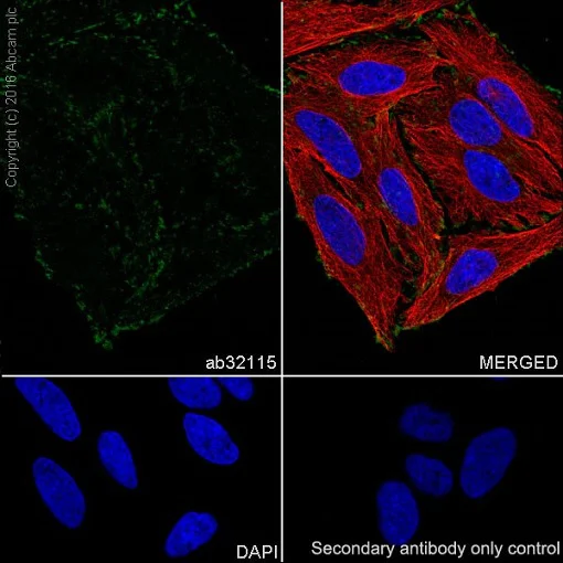 Immunocytochemistry/ Immunofluorescence - Anti-Paxillin antibody [E228] - BSA and Azide free (AB238950)