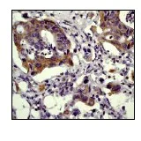 Immunohistochemistry (Formalin/PFA-fixed paraffin-embedded sections) - Anti-Paxillin antibody [E228] - BSA and Azide free (AB238950)