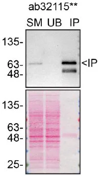 Immunoprecipitation - Anti-Paxillin antibody [E228] - BSA and Azide free (AB238950)