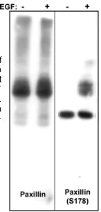 Western blot - Anti-Paxillin antibody [M107] (AB23510)