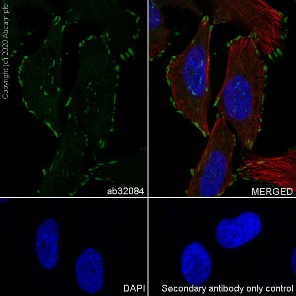Immunocytochemistry/ Immunofluorescence - Anti-Paxillin antibody [Y113] (AB32084)