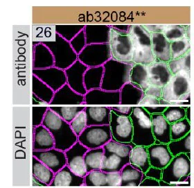 Immunocytochemistry/ Immunofluorescence - Anti-Paxillin antibody [Y113] (AB32084)
