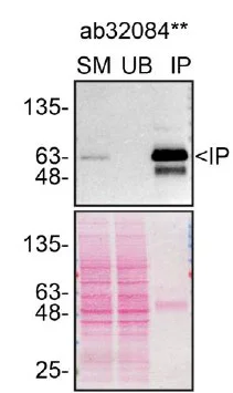 Immunoprecipitation - Anti-Paxillin antibody [Y113] (AB32084)
