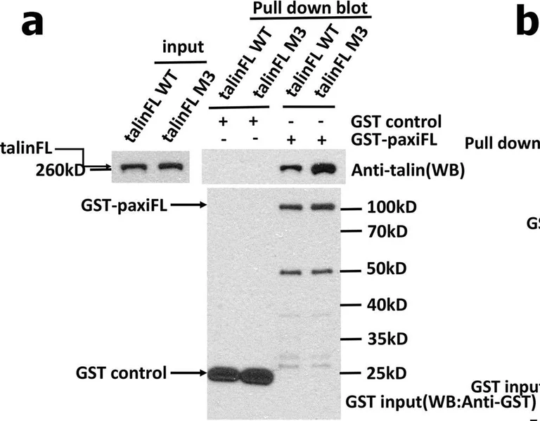 Western blot - Anti-Paxillin antibody [Y113] (AB32084)