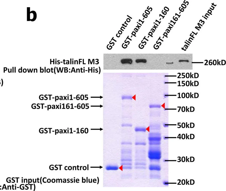 Western blot - Anti-Paxillin antibody [Y113] (AB32084)
