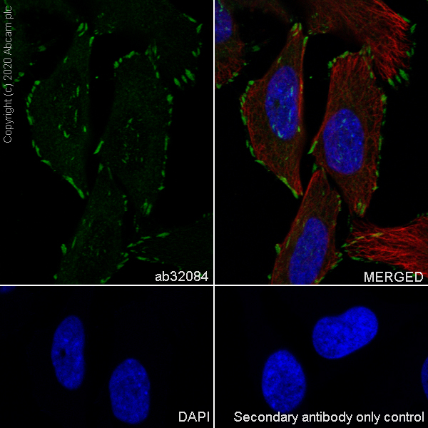 Immunocytochemistry/ Immunofluorescence - Anti-Paxillin antibody [Y113] - BSA and Azide free (AB216652)