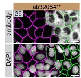 Immunocytochemistry/ Immunofluorescence - Anti-Paxillin antibody [Y113] - BSA and Azide free (AB216652)