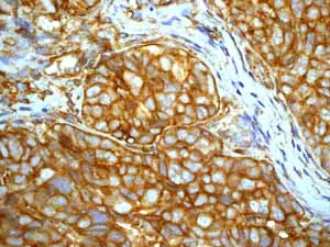 Immunohistochemistry (Formalin/PFA-fixed paraffin-embedded sections) - Anti-Paxillin antibody [Y113] - BSA and Azide free (AB216652)
