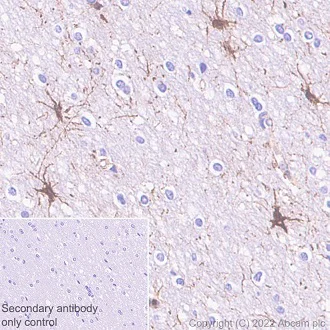 Immunohistochemistry (Formalin/PFA-fixed paraffin-embedded sections) - Anti-Paxillin antibody [Y113] - BSA and Azide free (AB216652)