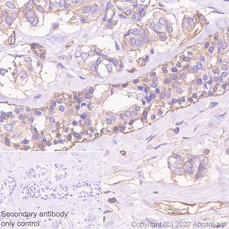 Immunohistochemistry (Formalin/PFA-fixed paraffin-embedded sections) - Anti-Paxillin antibody [Y113] - BSA and Azide free (AB216652)