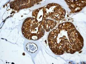Immunohistochemistry (Formalin/PFA-fixed paraffin-embedded sections) - Anti-Paxillin antibody [Y113] - BSA and Azide free (AB216652)